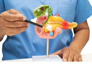 A laparoscopic surgeon explaining the gallstone surgery