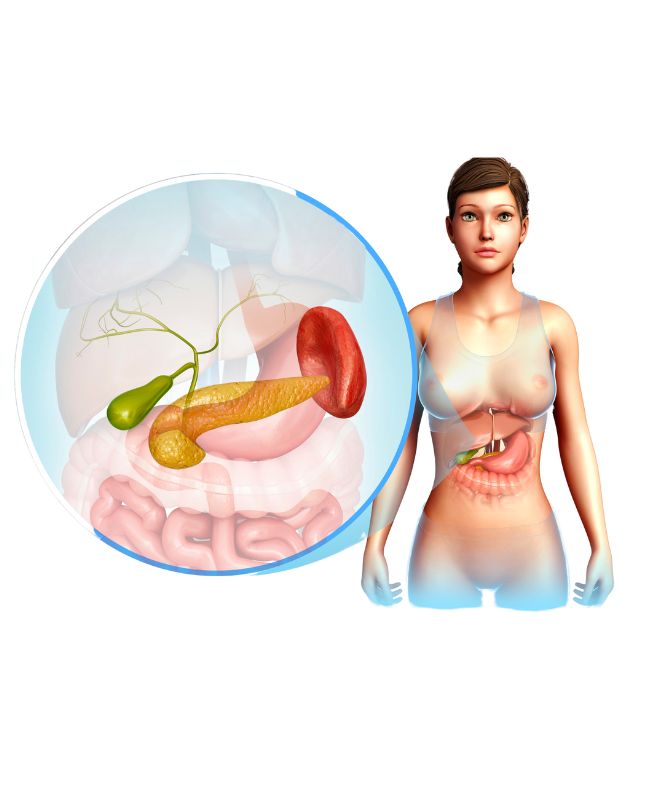 A diagram shwoing the complications of Gallstone