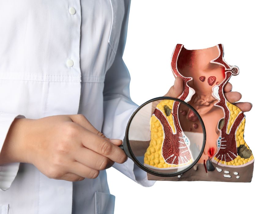 Doctor explaining anal fissure